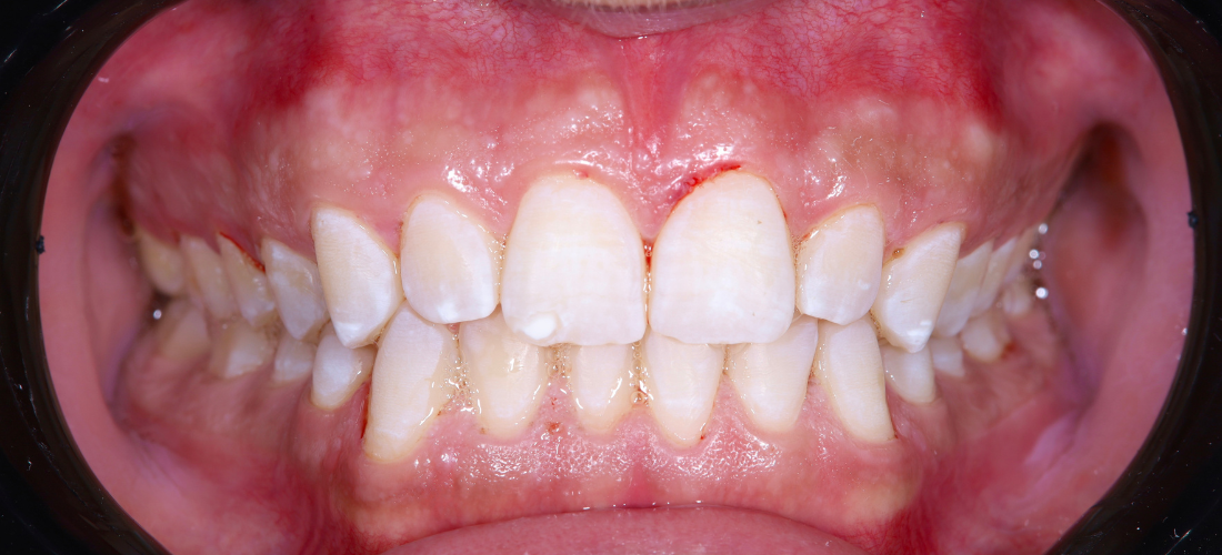 التنظيف والتلميع 2